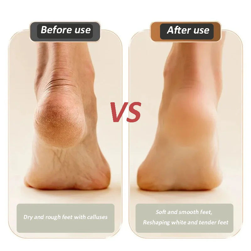 🔥HOT SALE💝New Digital Electric Foot Polisher
